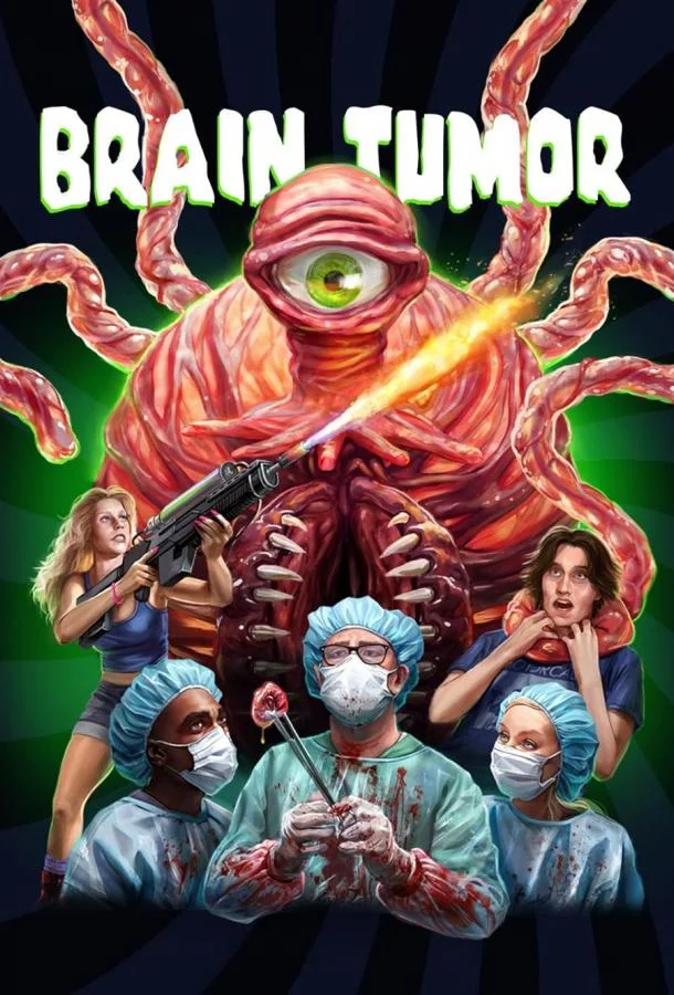 Опухоль мозга смотреть онлайн бесплатно в хорошем качестве